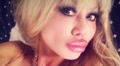 Hrozí, že jej explodujú silikóny. Aj tak chce väčšie!