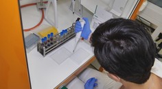 Test na protilátky je sporným hitom. Výsledné číslo vám veľa nepovie