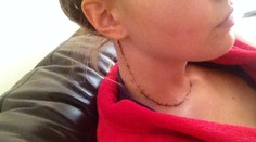 Postúpila do finále miss, teraz sa však cíti ako Frankenštajn