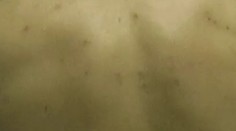 Chorôb sa zväčša stránime, ale jednu niektorí vyhľadávajú