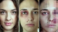 Volanie o pomoc! Video s fotkami ženy, ktorú mláti priateľ