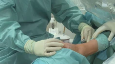 Rýchlejšie hojenie rán, menej jaziev aj bolesti. V Košiciach operujú nohy unikátnou metódou