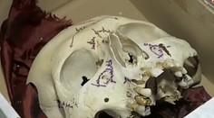 Do redakcie nám niekto poslal ľudskú lebku. Zisťovali sme, komu patrí