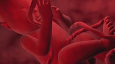 Matka má tri možnosti, ako naložiť s pupočníkovou krvou po pôrode. Čo odporúčajú odborníci?