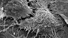 Rakúsko: Žena hospitalizovaná vo Viedni netrpí na ebolu