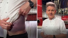 Svetoznámy šéfkuchár Gordon Ramsay mal nehodu. Na Deň otcov prichádza s dôležitým posolstvom