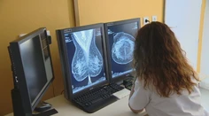 Preventívne sono prsníkov končí. Ženy sa vraj majú spoliehať na samovyšetrenie, časť lekárov protestuje