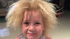 Dievčatko trpí rovnakým syndrómom ako Einstein. Svoje vlasy nikdy neučeše