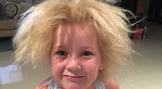 Dievčatko trpí rovnakým syndrómom ako Einstein. Svoje vlasy nikdy neučeše