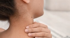 Ako spoznať nebezpečné znamienko? Pomôže jednoduché pravidlo ABCDE