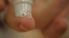 Zázračný liek z Ruska. V rekordnom čase vylieči ranu