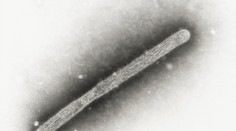 WHO potvrdila prvý smrteľný prípad vtáčej chrípky H5N2 u človeka