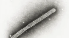 WHO potvrdila prvý smrteľný prípad vtáčej chrípky H5N2 u človeka