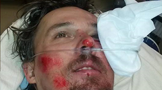 FOTO: Ondřej Bank si pamätá len začiatok, takto vyzerá po páde