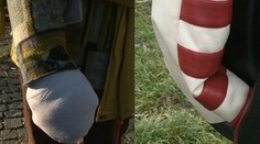 Košičan, ktorému odrezali znetvorenú ruku, prehovoril