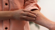Kožná forma celiakie. Durhingova choroba sa prejavuje vyrážkami podobnými herpesu