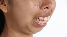 Úžasná premena tínedžerky. Teraz je z nej neskutočná krásavica