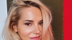 Dara si nechala upraviť nos. Samozvaným odborníkom posiela odkaz