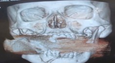 Žene vytiahli z úst niečo nevídané. Aj lekárom šlo o život