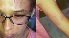 Riaditeľ súkromnej školy, ktorý mal žiakovi obúchať hlavu o zem, na súd neprišiel