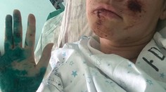 Hrozivá autonehoda. Vicemisska skončila na vozíku