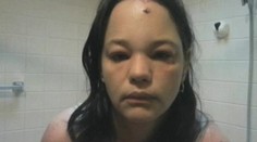 Šokujúce video: Mačka brutálne napadla majiteľku