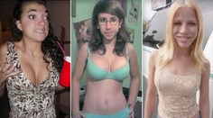 FOTO: Telá týchto žien vyzerajú dokonalo. Ale čo tie tváre?