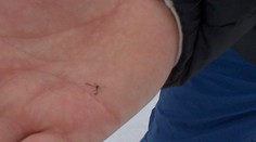 FOTO: Na lyžiarskom svahu v Levoči sa objavili komáre