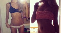 Z anorektičky je dnes neuveriteľná sexica