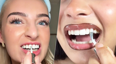 Biely úsmev za sekundu? Dentálna hygienička vysvetľuje, čo sa skrýva za virálnym lakom na zuby