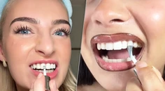 Biely úsmev za sekundu? Dentálna hygienička vysvetľuje, čo sa skrýva za virálnym lakom na zuby