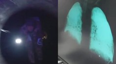 Ruskí vojaci sa zakrádali 15 kilometrov plynovodom, teraz trpia záhadnou chorobou. Lekári si s nimi nevedia rady