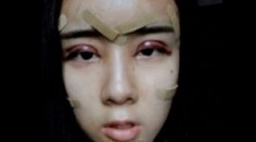 Pätnásťročná po extrémnych plastikách: Strašidelná či pekná?