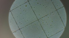 Dvadsaťroční majú horšie spermie, než 40-roční muži