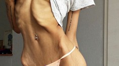 Úžasná premena. Dvojnásobná mamička porazila anorexiu po 17 rokoch