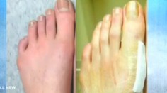 Takýto recept na nosenie topánok na podpätkoch ste ešte nevideli