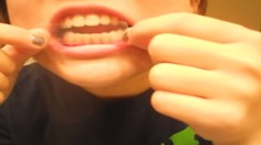 Nebezpečné bieliace pásiky si obľúbili aj Slovenky: Zuby úplne zničia