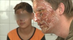 Nebezpečná hra slovenských detí: Na internete sa chvália výbuchmi