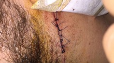 Desivé spomienky exfarmára: Stačilo málo a mohol vykrvácať