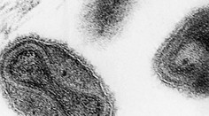 V americkom laboratóriu našli ampulky so smrtiacim vírusom