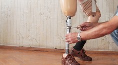 Unikátna operácia na Slovensku. Protéza, ktorá sama predĺži nohu