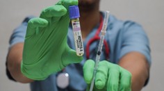 Obavy zo žltačky spustili u našich susedov nápor na ambulancie a lekárne: Vakcíny sú po výpadku opäť dostupné