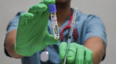 Obavy zo žltačky spustili u našich susedov nápor na ambulancie a lekárne: Vakcíny sú po výpadku opäť dostupné