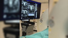 Nádory odstraňujú mrazom či vysokým teplom. Špeciálna metóda je na vzostupe