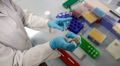 Pribudlo ďalších osem obetí koronavírusu, počet nových prípadov nákazy je takmer 3000