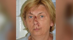 V Chorvátsku našli dezorientovanú ženu. Ozvala sa čitateľka, ktorá tvrdí, že ide o Slovenku