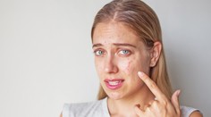 Jedzte tieto potraviny! Pomôžu vám k dokonalej pleti