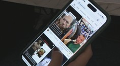 Údery do lícnych kostí či karfiolové ucho. Lekári varujú pred nebezpečnými trendmi mladých