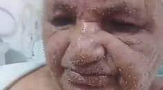 To musela byť hrozná bolesť. Tvár i telo staršej ženy pobodali stovky včiel