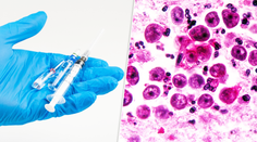 Liek proti smrteľnej amébe, ktorá desí Slovákov? Českí vedci majú sľubnú odpoveď, chýba im však jedna vec